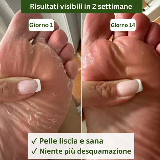 Sapone Antimicotico Myrovea